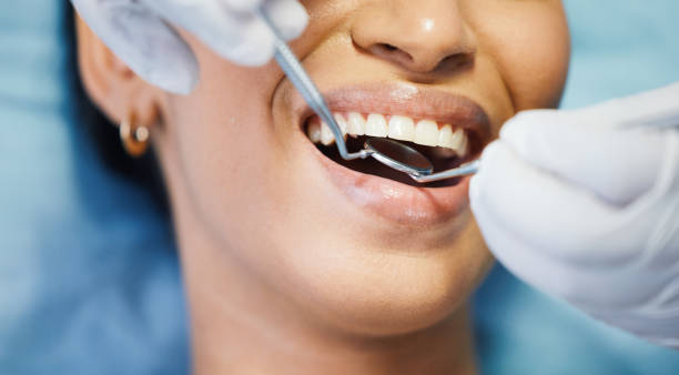 Best Emergency Tooth Extraction in Fife, WA